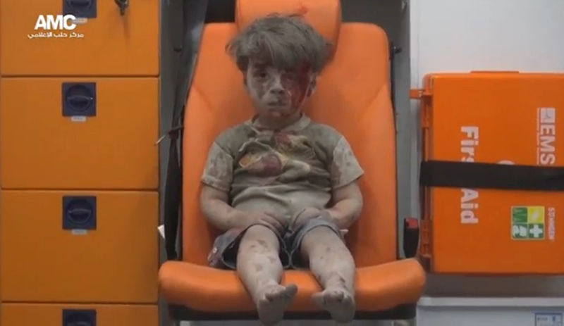 © Reuters. A still image from a video posted on social media shows a boy with bloodied face sitting in an ambulance, after an airstrike