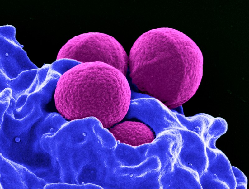 © Reuters. Las "superbacterias" avanzas mientras a EEUU se le escapan las cifras