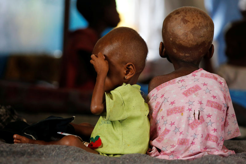 © Reuters. Crianças desnutridas em hospital da República Democrática do Congo