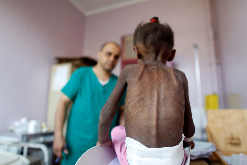 © Reuters. Naciones Unidas advierte de la hambruna que asola a la población civil de Yemen.