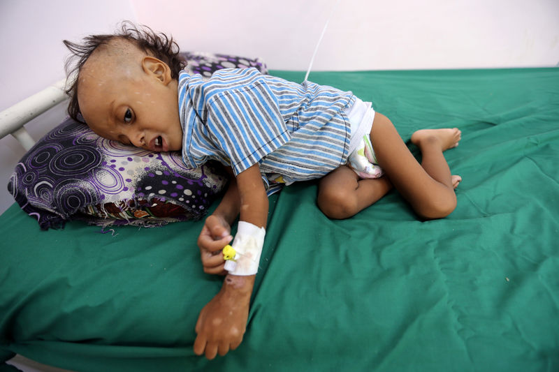 © Reuters. Menino de 2 anos em leito de hospital de Hodeidah, no Iêmen