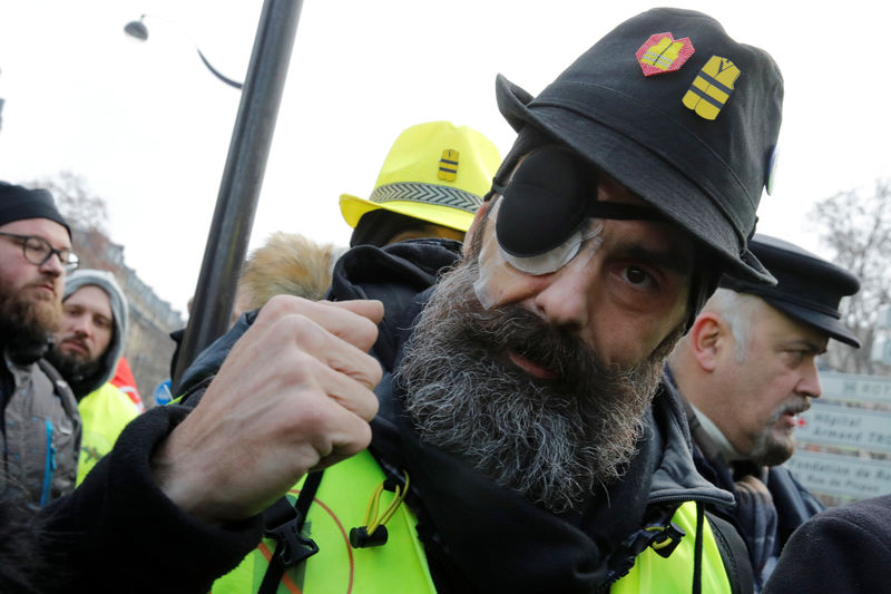 © Reuters. Foto del sábado de  Jerome Rodrigues, herido durante las manifestaciones de los "chalecos amarillos", en una nueva marcha en París