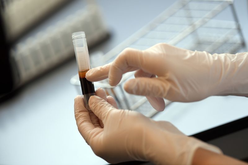 &copy; Reuters. Pesquisaora analisa amostra de sangue de doador em Erlangen, na Alemanha