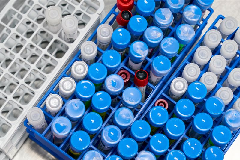 © Reuters. FILE PHOTO: RealTime Laboratories testing samples for the coronavirus disease (COVID-19) in Carrollton, Texas