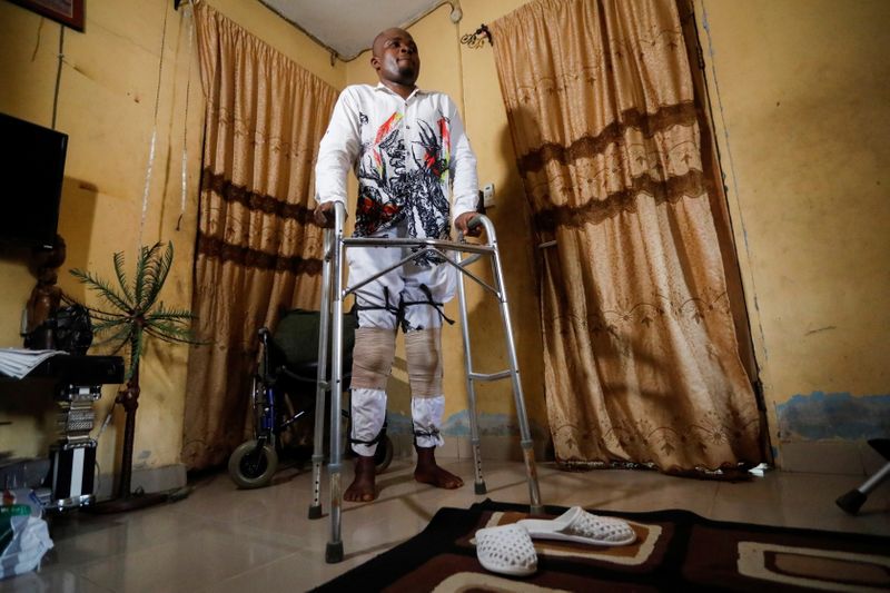 &copy; Reuters. FILE PHOTO: Ndukwe Ekekwe, a victim of the Nigerian police brutality, uses crutches as he stands in his home in Lagos, Nigeria November 19, 2020. REUTERS/Temilade Adelaja